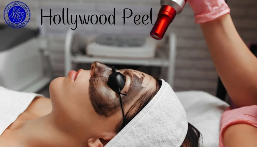 hollywood peel