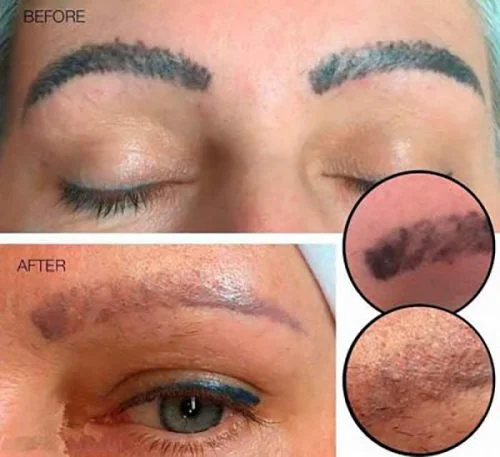 peligros micropigmentación y microblading